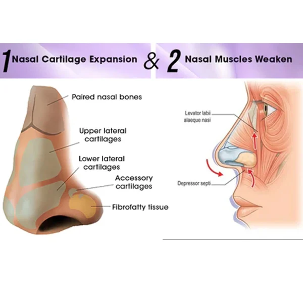 Silicone Nose Shaper Up Clip Lifter nose up lifting snapping Rhinoplasty Beautiful Bridge Straightening Low Nose Curved No Pain - Image 2
